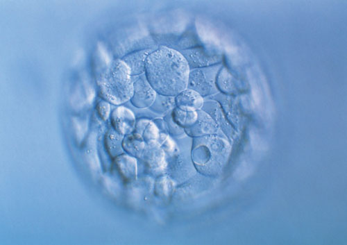 药流产后多久可以上班